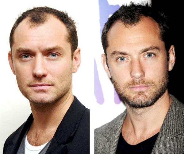 Знаменитые мужчины до и после бритья (23 фото)